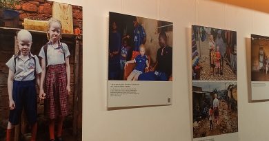 Santé : La Fondation Pierre Fabre consacre une exposition photographique à l&rsquo;albinisme en Afrique